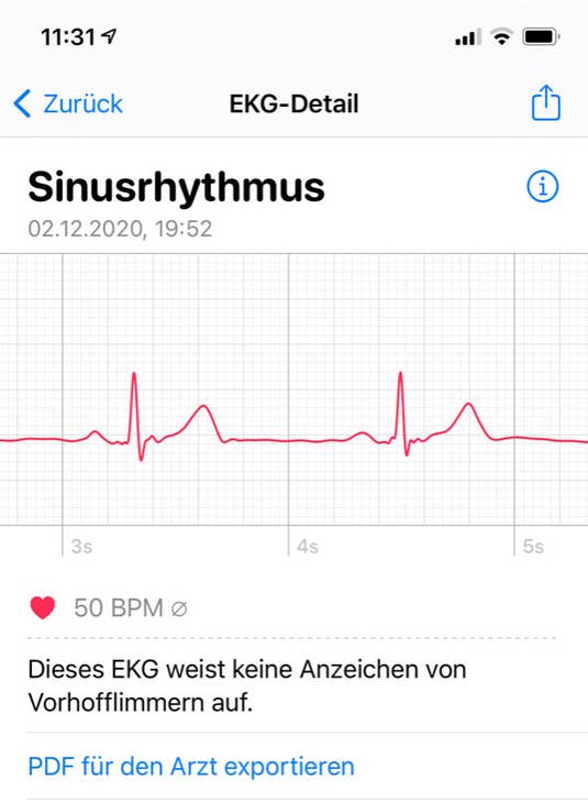 EKG Apple Watch Series 6