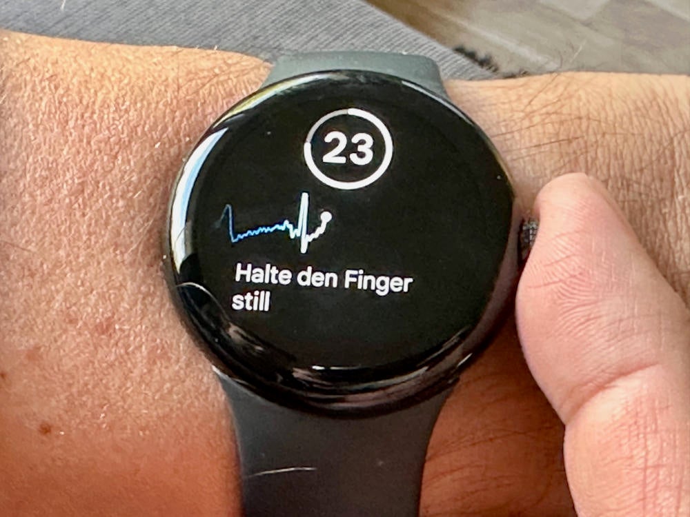 EKG-Funktion auf der Google Pixel Watch