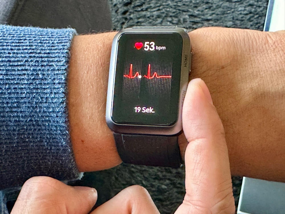 EKG-Erstellung auf der Huawei Watch D