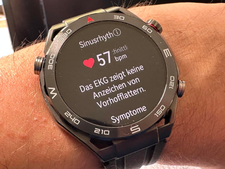 Huawei Watch Ultimate Ergebnis EKG-Messung.