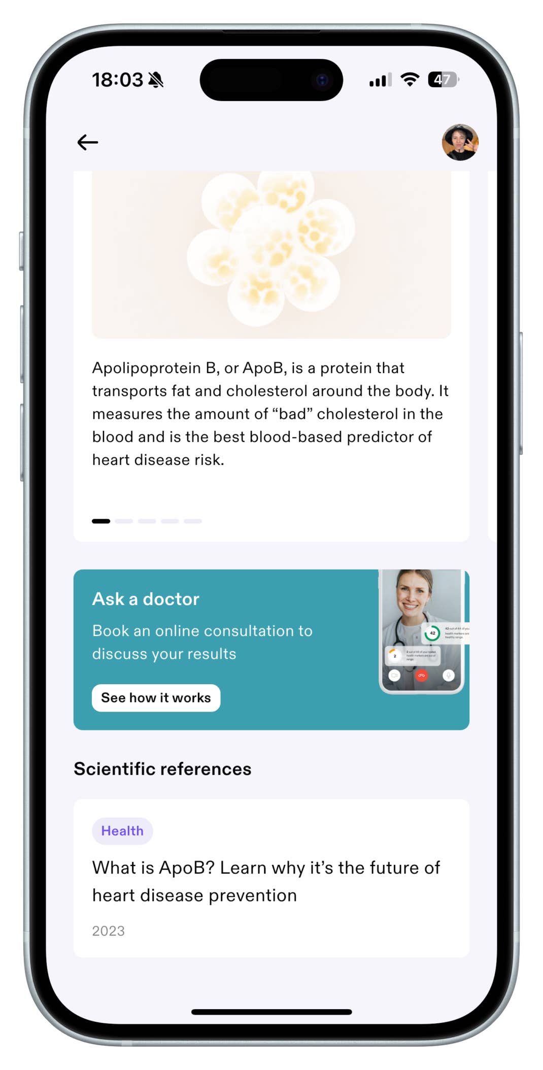 Mobilbildschirm zeigt die Aware-App mit Informationen zu Apolipoprotein B und Optionen für Online-Beratung.