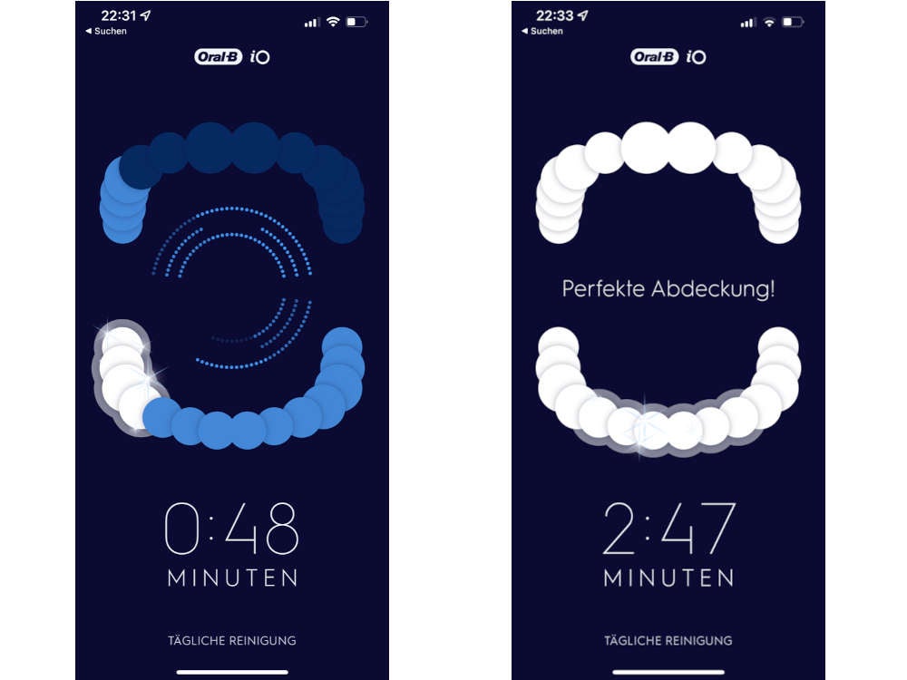 Screenshots aus der Oral-B iO App.