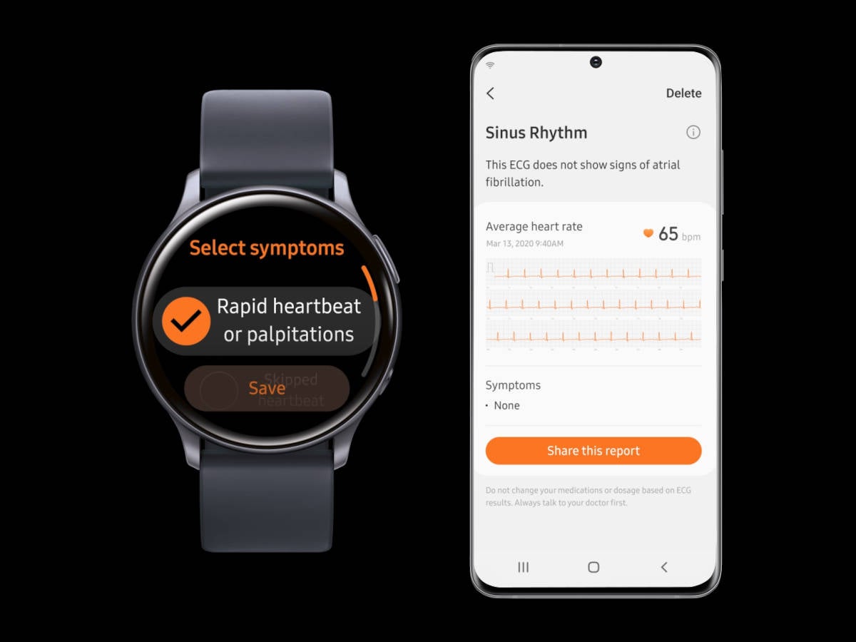 ekg samsung