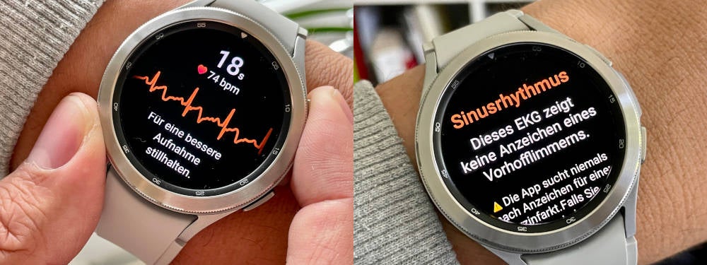 EKG-Funktion auf der Samsung Galaxy Watch4 Classic