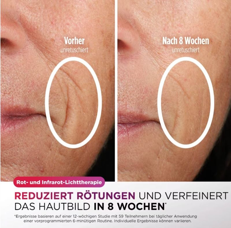 Die Shark CryoGlow LED-Maske soll das Hautbild merklich verbessern