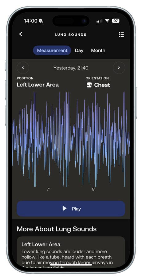 BeamO sendet die Lungentondaten direkt an die App und ermöglicht so einen einfachen Zugriff.