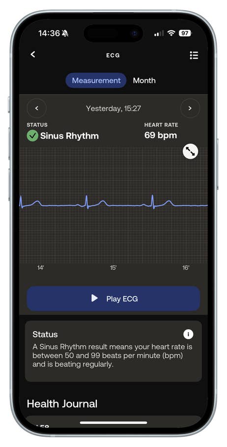 Withings-BeamO-EKG-Messung, die einen Sinusrythmus zeigt.